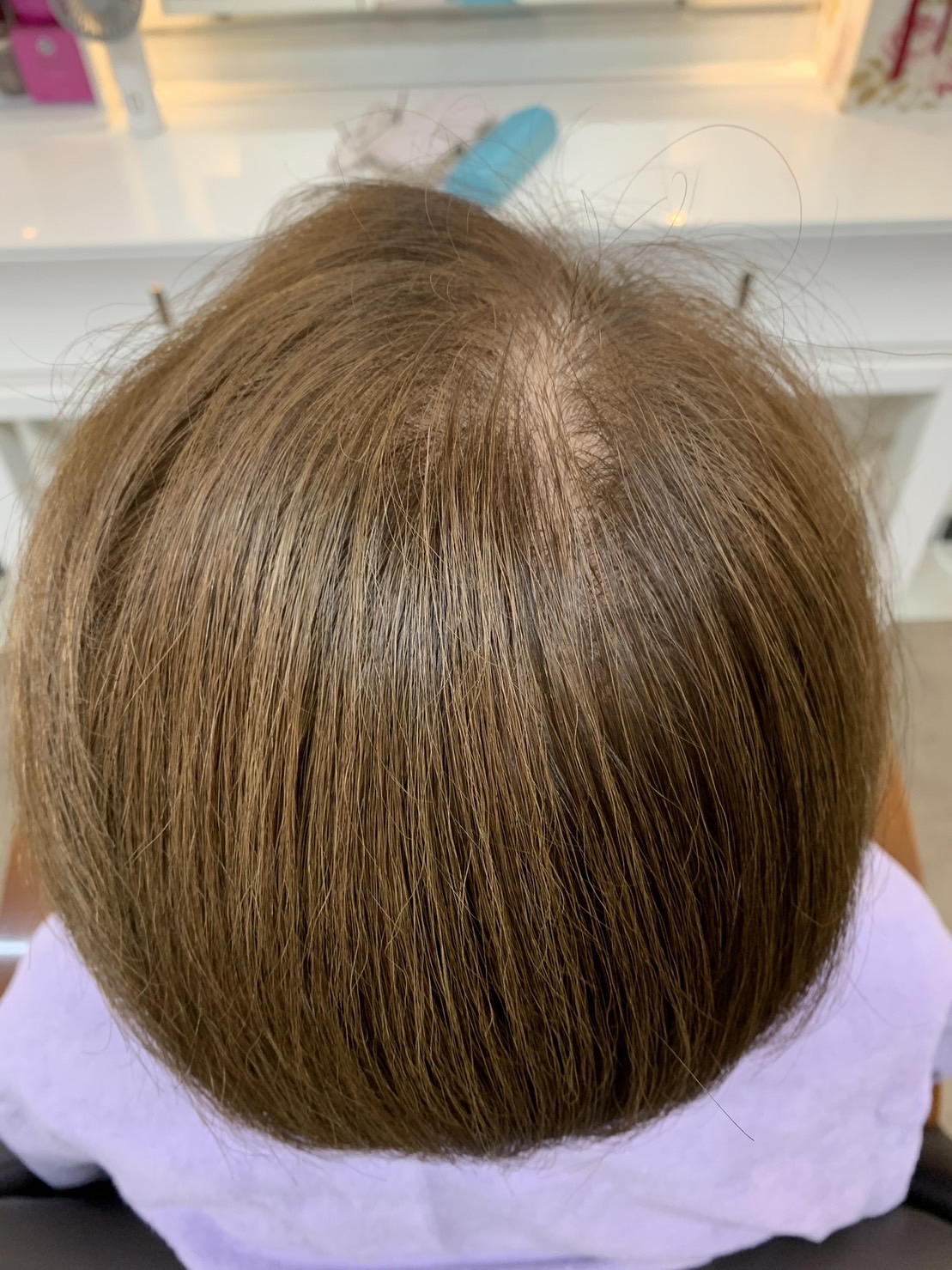 Hair Resetter施術前後の確認イメージ
